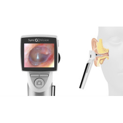 Otoscope digital IO1 Elite SyncVision 