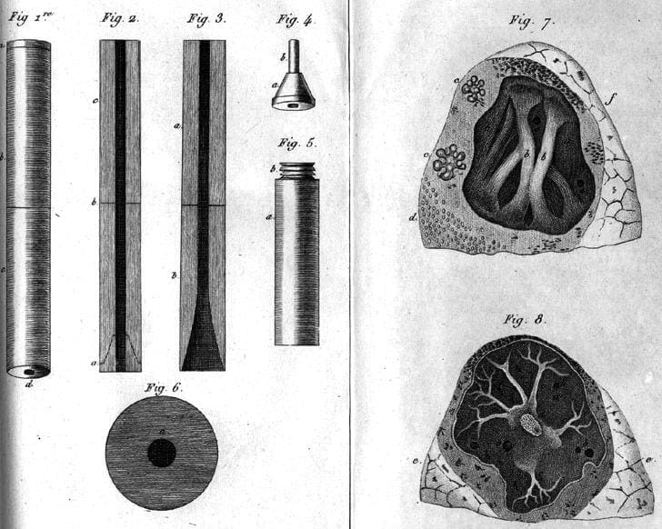 En 1816, René Laennec révolutionne la médecine avec l'invention du ...