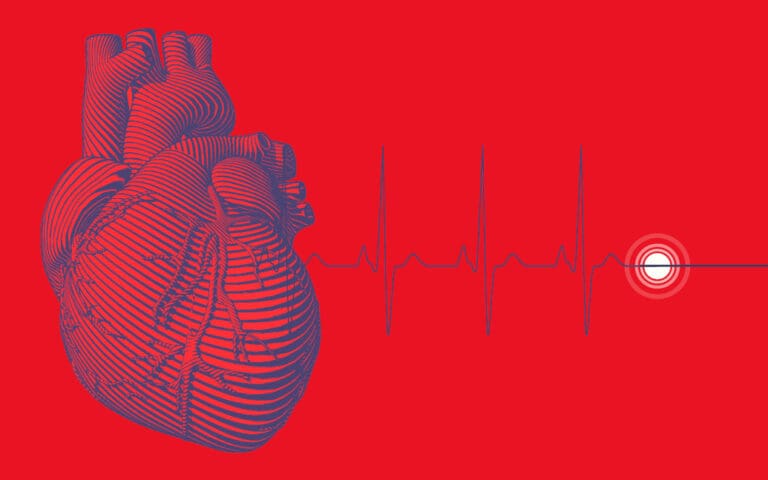5 idées reçues sur l’arrêt cardiaque