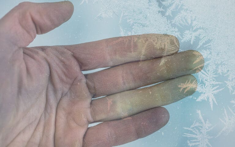 Pourquoi prévenir l’hypothermie est vital ?