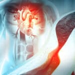 L’importance du dépistage précoce de l’amylose cardiaque