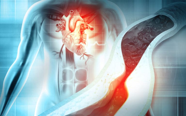 L’importance du dépistage précoce de l’amylose cardiaque