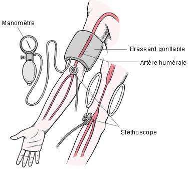 Comment prendre une tension artérielle avec un stéthoscope ?