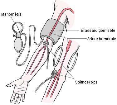 Comment utiliser un otoscope: 13 étapes (avec images)